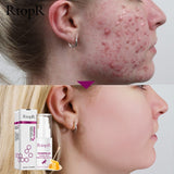 Cleaning Serum Shrink Pores Eliminates Acne Treatment Oil control